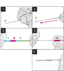 Vision Nano Loops - łączniki do linek